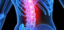 Spinal Cord Injury Lawyer